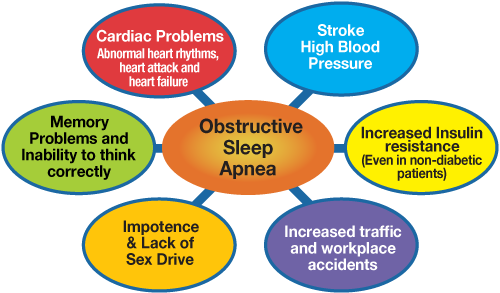 Obstructive Sleep Apnoea and Comorbidities