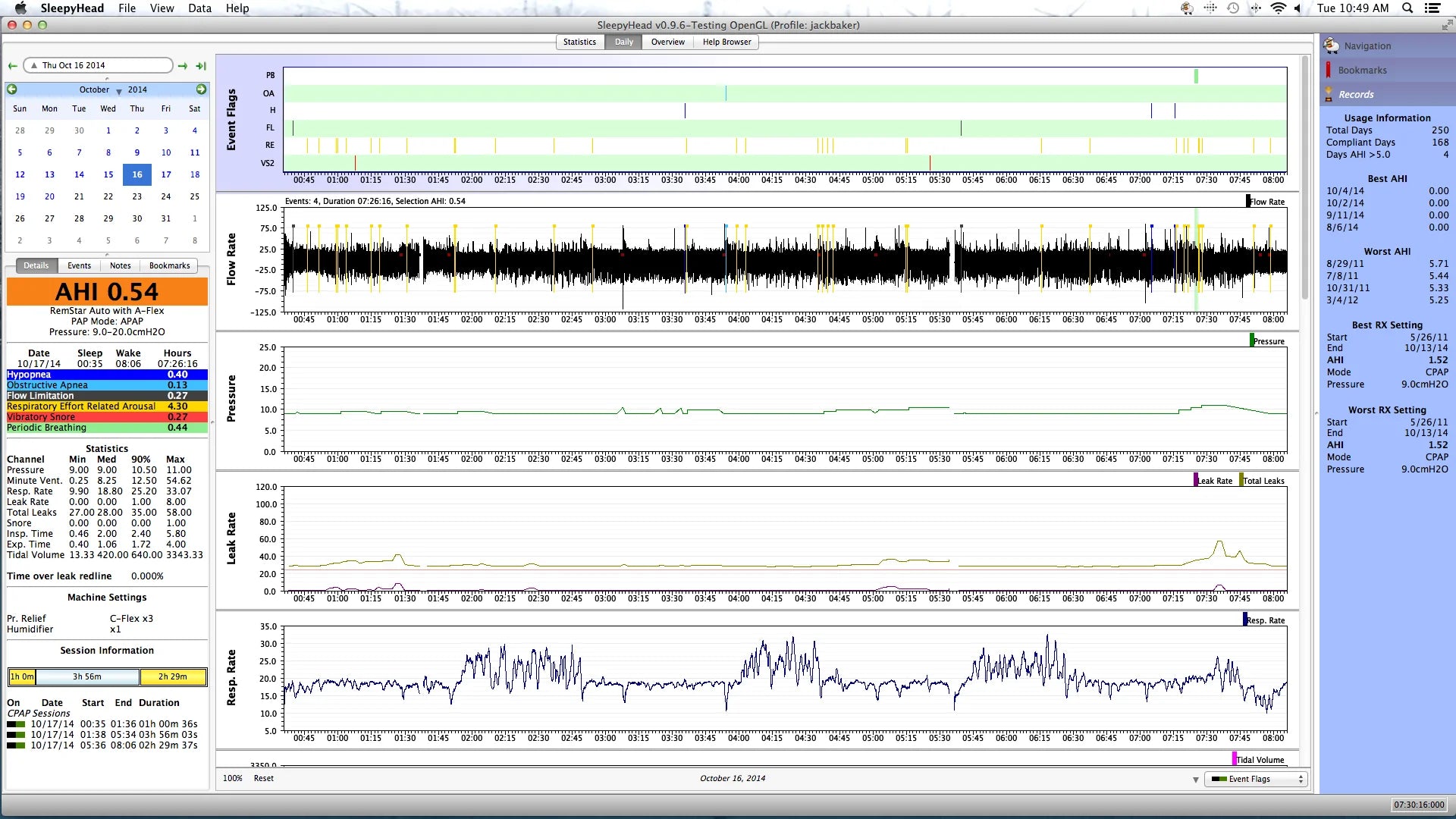 CPAP Data Analysis