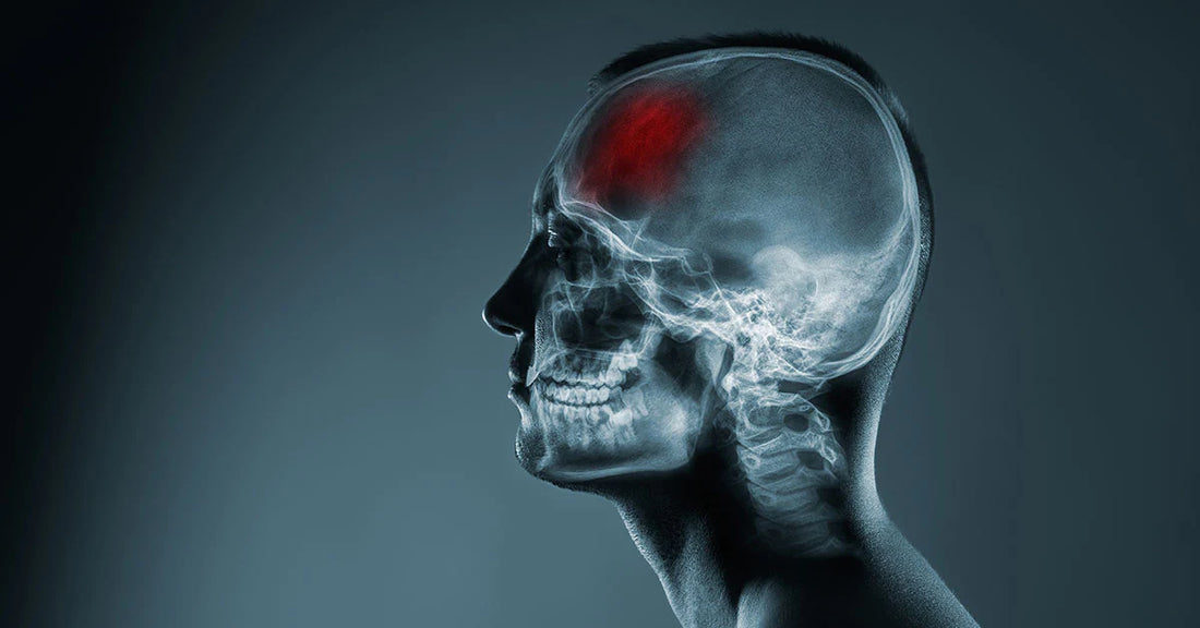 Don’t sleep-walk into dementia